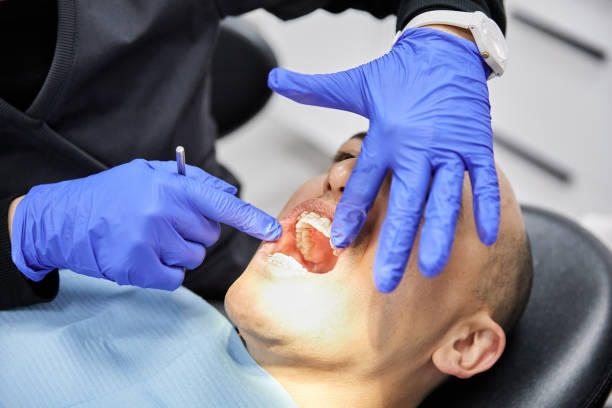 Best Emergency Root Canal Treatment in West Perrine, FL