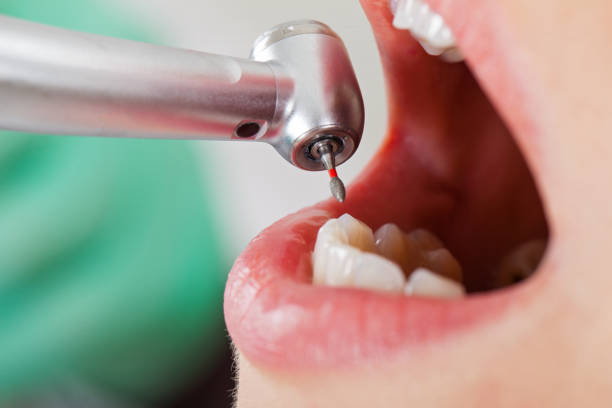 Best Emergency Dental Services for Seniors in West Perrine, FL